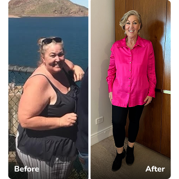 michelle-before-after